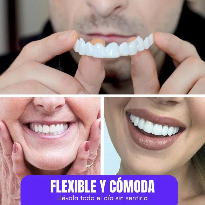 DentalGlow® Carillas de Resina para una Sonrisa Natural 