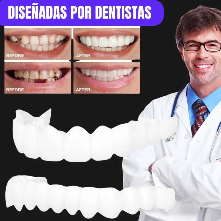 DentalGlow® Carillas de Resina para una Sonrisa Natural 